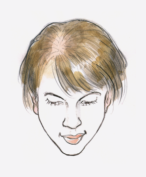 Schmererderfriseur Haarausfall Frauen Genetischbedingt01