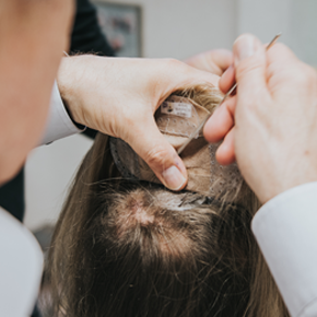 schmerer-zweithaar-haarintegration-tritec-lupe